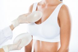 breast augmentation